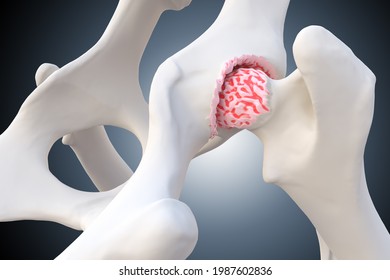 Canine Arthritis and Osteoarthritis joint inflammation, deterioration of joint in dogs, 3d illustration