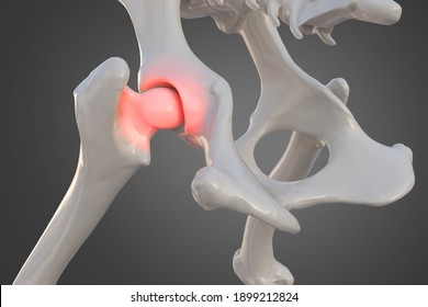 Canine dysplasia, dog bone with visible hip joint and femur affected by inflammation due to dysplasia, 3d illustration