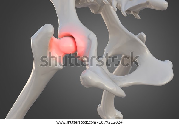 Canine\
dysplasia, dog bone with visible hip joint and femur affected by\
inflammation due to dysplasia, 3d\
illustration