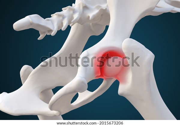 Canine dysplasia, dog bone with visible hip\
joint and femur affected by inflammation due to dysplasia red area,\
3d illustration