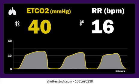 Capnography Monitor Equipment Screen - ETCO2 And RR