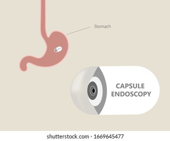 Capsule Endoscopy Or Gastroenterology Pill-sized Camera Pillcam For Stomach Diagnosis. Medical Illustration 3d Render Of New Technology Capsule Endoscopy Pill Cam.