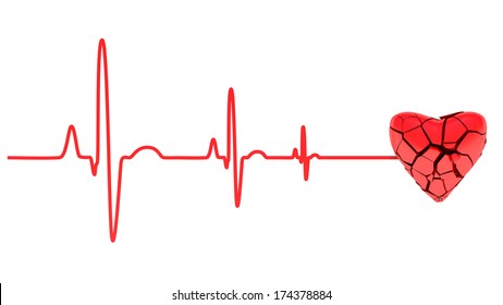 Cardiac Arrest, ECG