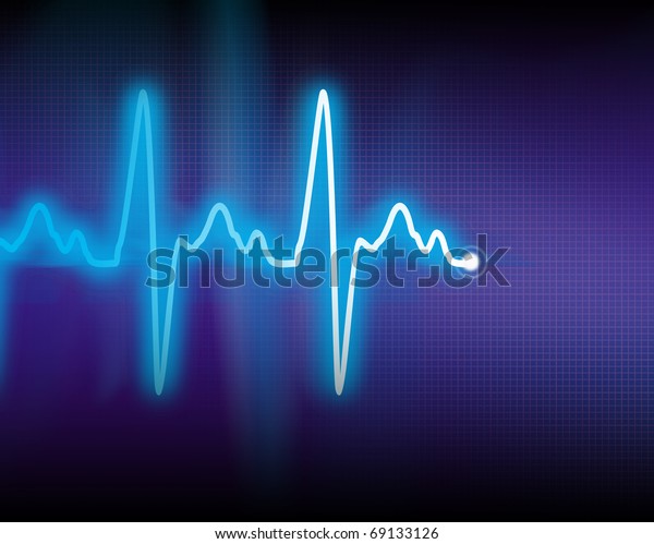 radio cardiograph