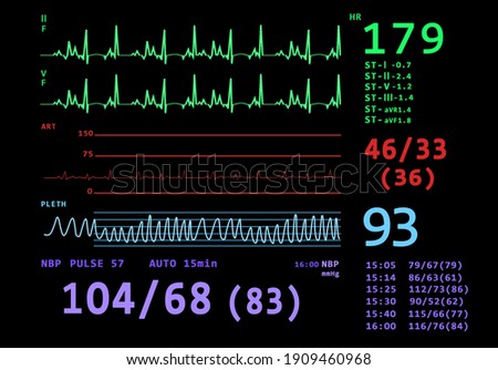 Cardiogram and data on display of heart rate monitor. Illustration