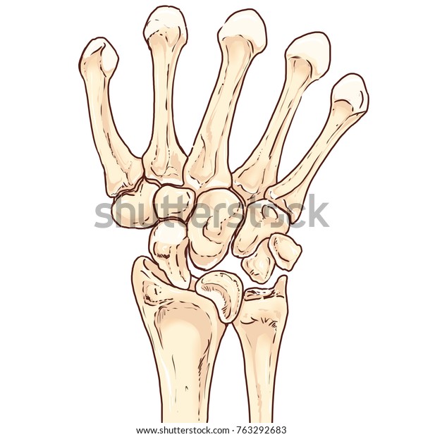 Carpal Bones Dislocation Illustration Stock Illustration 763292683