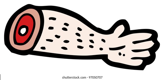 Cartoon Severed Arm