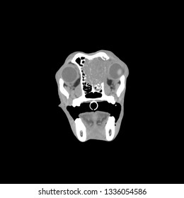 Cat scan CT scan of the head of a dog with a nasal tumor that is destroying the bones of the skull and invading the brain 