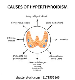 The causes of hyperthyroidism of the thyroid gland. Infographics. illustration on isolated background.