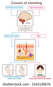 Causes Sweatingwhy Do We Sweat Stock Illustration 1565130676 | Shutterstock