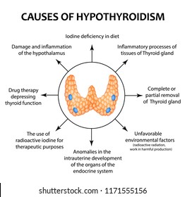 The causes of thyroid hypothyroidism. Infographics. illustration on isolated background.