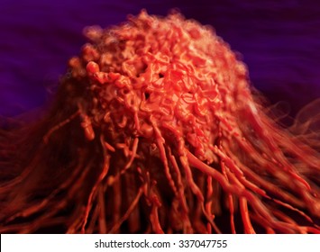 Cervical Cancer Cell