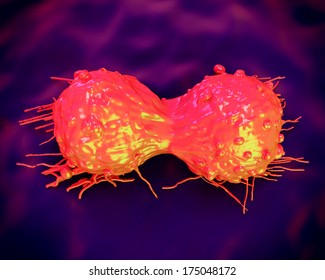 Cervical Cancer Cell, SEM Of Cervical Carcinoma