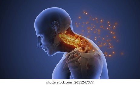 Cervical Posture Syndrome Causing Neck Strain 3d illustration