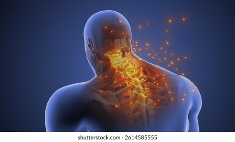 Cervical Posture Syndrome Causing Neck Strain 3d illustration