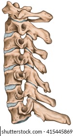 Spine Disc Problems Degenerative Lumbar Disc Stock Illustration 405564427