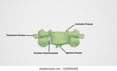 typical cervical vertebra