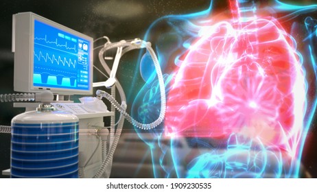 Cg Medical 3d Illustration, Human Lungs And ICU Medical Ventilator