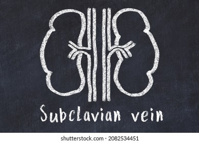 Chalk Drawing Of Human Kidneys And Medical Term Subclavian Vein. Concept Of Learning Medicine.