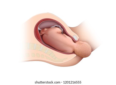 Childbirth. Leaving Babies In The Womb