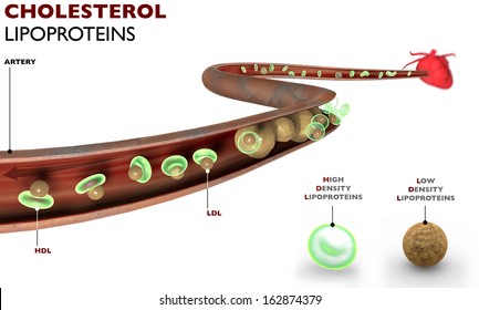 Cholesterol, fat formation, lipoproteins, artery, heart. HDL are lipoproteins that pick up cholesterol and carry it to the liver. LDL are lipoprotein that free cholesterol on the walls of the arteries