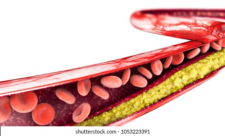 Cholesterol formation, fat, artery, vein, heart. 3d rendering