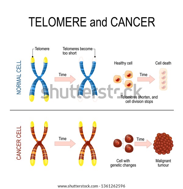 Chromosome and telomere for healthy and cancerous\
cells. In a normal cell Every time a cell divides, telomeres become\
shorter. In cancer cells, telomeres remain unchanged. The\
development of\
cancer