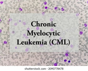 Chronic Myelocytic Leukemia (CML) Term. Health And Medical Concept.