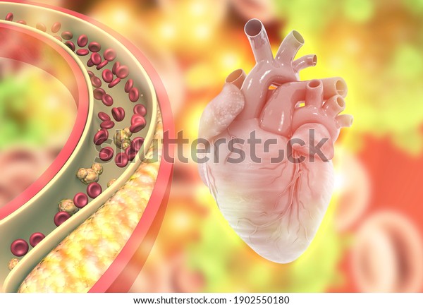 Clogged arteries
with heart. 3d
illustration		