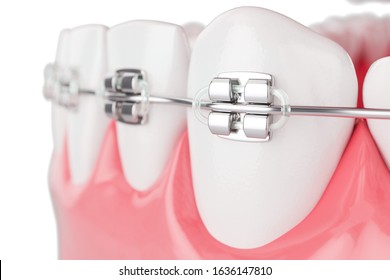 Close up Beauty Health Teeth with Brace on white background. Selective focus. 3D Render.