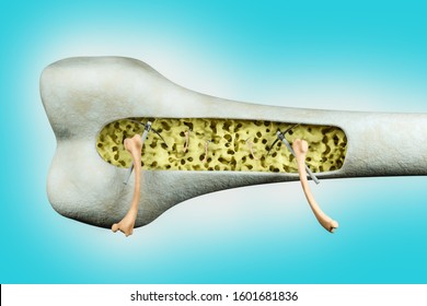 Close Up Of Human Thighs Bones Trying To Fix Osteoporosis Problem Inside The Human Thigh Bone In Blue Background. Osteoporosis World Day Or Retirement Age Or Strong Bones Concept. 3D Illustration