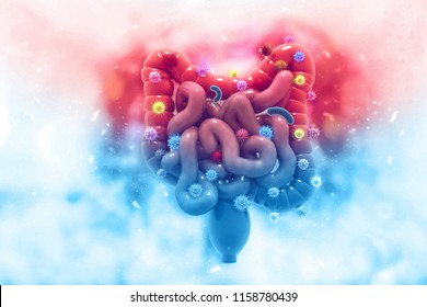 Colon cancer. Cancer attacking cells. Colon disease concept. 3d illustration 