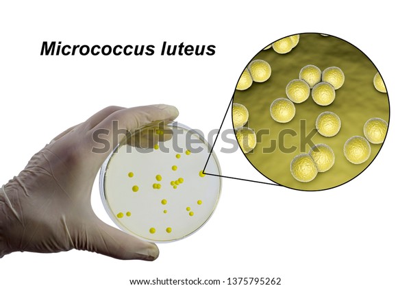 寒天板上のマイクロコッカス ルテウス菌群と マイクロコッカス菌 写真 3dイラストの接写 のイラスト素材