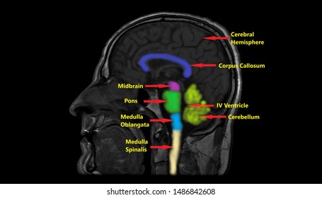 Colored And Annotated MRI Anatomy Of Brain (Saggital Plane)