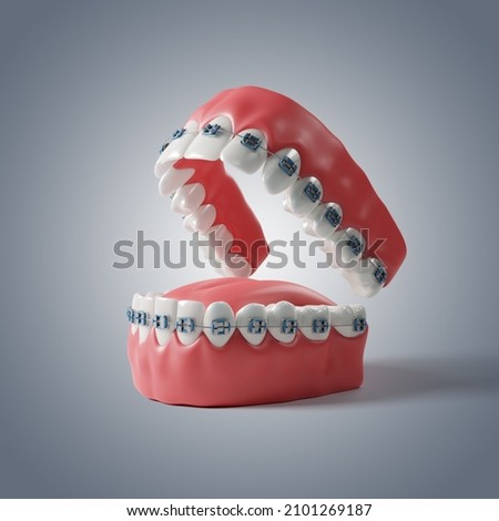 Colored Orthodontics on BG 3D Illustration ストックフォト © 