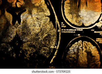 Colorful X-ray Scan Of Brain