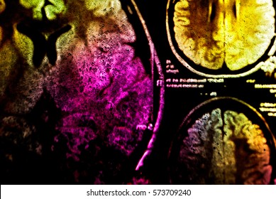 Colorful X-ray Scan Of Brain