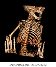Computed tomography (CT) of the pediatric thorax demonstrates a soft tissue mass adjacent to the heart with multiplanar and volume-rendered reconstruction. CT imaging enables detailed assessment of lesion morphology, anatomical relationships with the heart and mediastinal structures, and provides valuable information for differential diagnosis, surgical planning, and multidisciplinary clinical evaluation