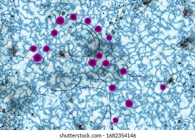 Computer Modeling Of COVID-19 Virus From Electron Micrograph Background.