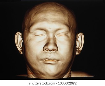 A Computer Tomography 3D Reconstruction Image Of A Human Face.