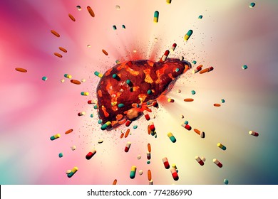 Conceptual Image Of Drug-induced Hepatotoxicity, 3D Illustration