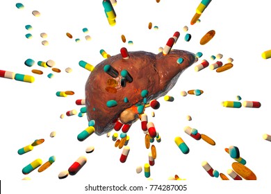 Conceptual Image Of Drug-induced Hepatotoxicity, 3D Illustration