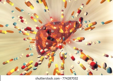 Conceptual Image Of Drug-induced Hepatotoxicity, 3D Illustration