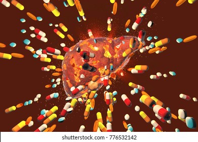 Conceptual Image Of Drug-induced Hepatotoxicity, 3D Illustration