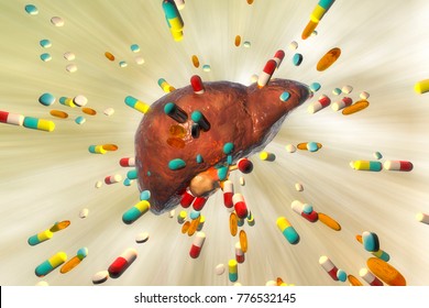 Conceptual Image Of Drug-induced Hepatotoxicity, 3D Illustration