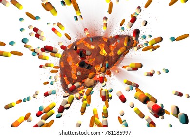 Conceptual Image Of Drug-induced Hepatotoxicity, 3D Illustration