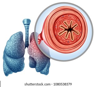 COPD Chronic Obstructive Pulmonary Disease As A Medical Concept For Lung Illness And Emphysema With 3D Illustration Elements.