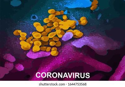 Coronavirus (COVID-19) Real Image From Electron Microscope