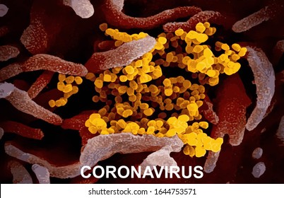 Coronavirus (COVID-19) Real Image From Electron Microscope