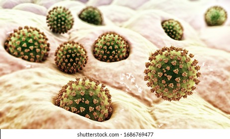 Coronaviruses SARS-CoV-2 Infecting Human Alveoli Cells, The Concept Of COVID-19 Spread And Infection Development, 3D Illustration